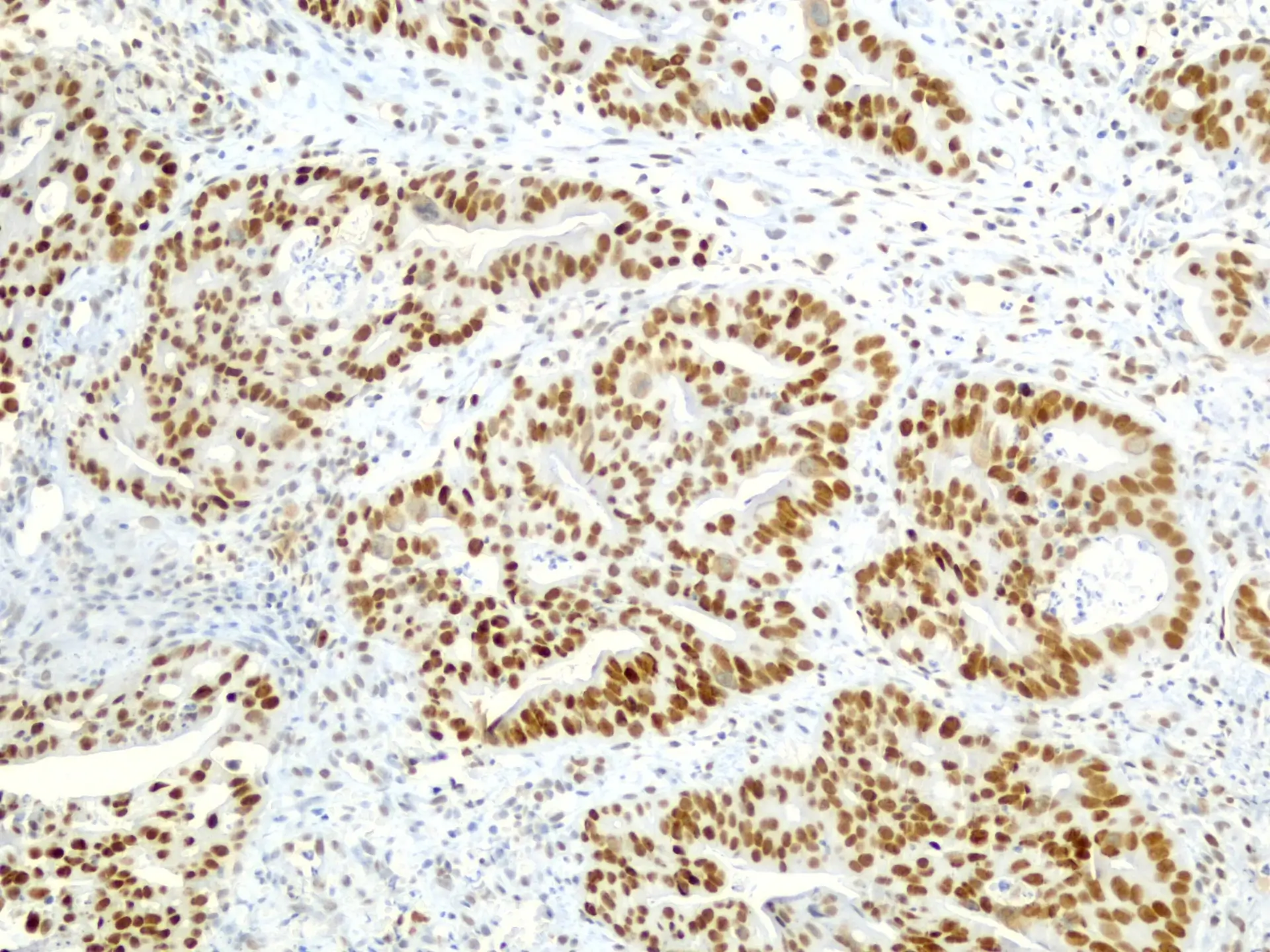 Immunhisztokémia