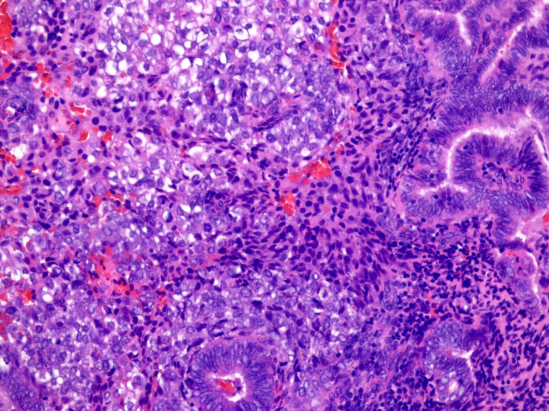 Méhtestrák-diagnosztika