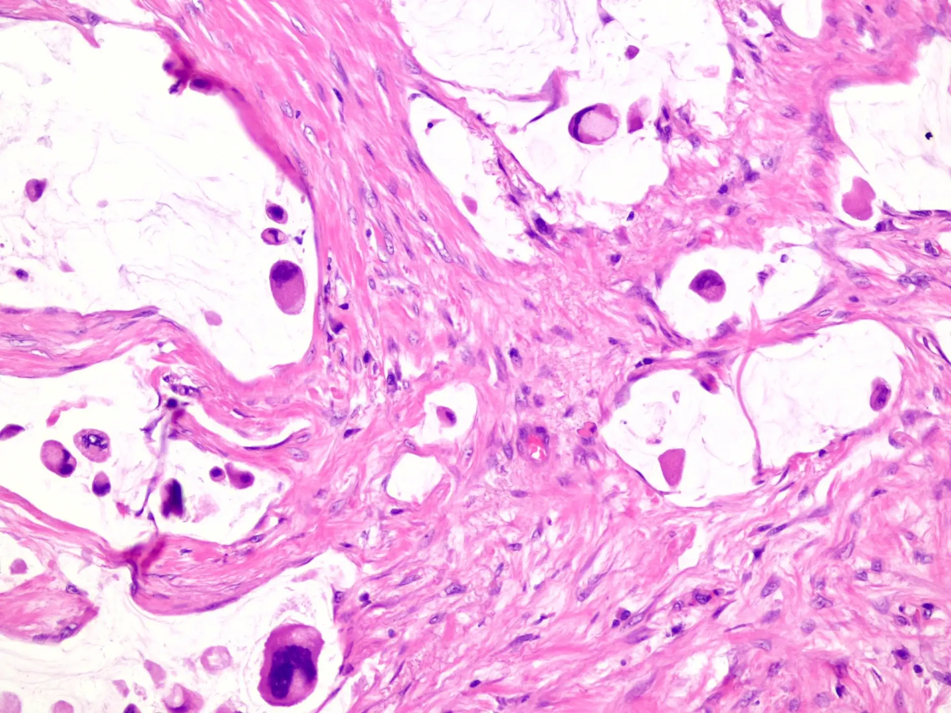 Vastagbélrák diagnosztika